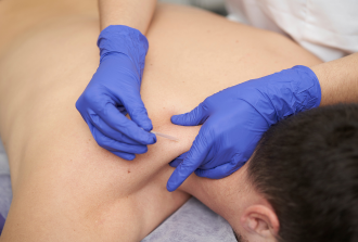 dry needling Melbourne